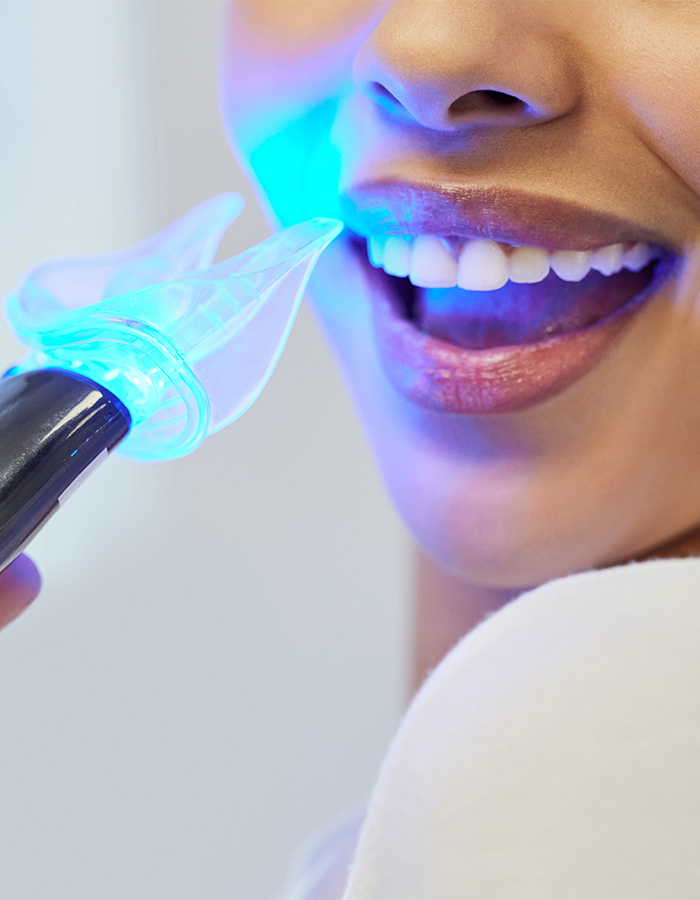 rl-academy-formation-institut-beaute-blanchiment-dentaire